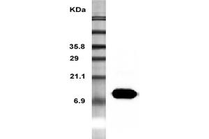 Western Blot analysis of recombinant resistin using anti-Resistin (mouse), mAb (MRES 06)  at 1:5000 dilution.