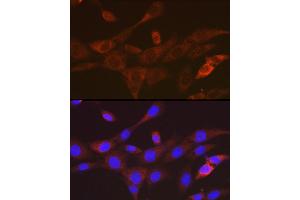 Immunofluorescence analysis of NIH-3T3 cells using T Rabbit mAb (ABIN7270916) at dilution of 1:100 (40x lens). (TACC3 抗体)