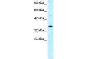 Western Blotting (WB) image for anti-General Transcription Factor IIH, Polypeptide 3, 34kD (GTF2H3) antibody (ABIN2460224) (GTF2H3 抗体)