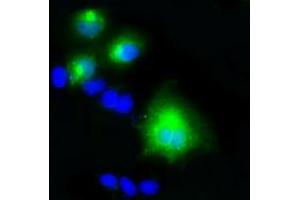 Anti-LIPG mouse monoclonal antibody (ABIN2453255) immunofluorescent staining of COS7 cells transiently transfected by pCMV6-ENTRY LIPG (RC209248). (LIPG 抗体)