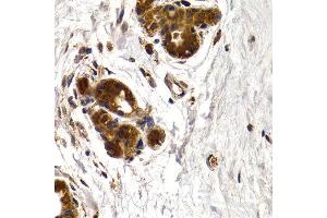 Immunohistochemistry of paraffin-embedded human normal breast using CTSS antibody at dilution of 1:200 (400x lens). (Cathepsin S 抗体)