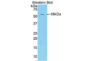 Western Blotting (WB) image for anti-Protein L-Myc (MYCL) (AA 184-454) antibody (ABIN1859919) (LMYC 抗体  (AA 184-454))