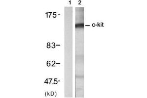 Western blot analysis of extract from A431 cell treated with EGF (200ng/ml, 30min), using c-Kit (Ab-721) Antibody (E021232, Lane 1 and 2). (KIT 抗体)