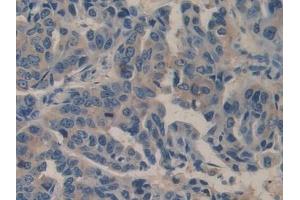 Immunohistochemistry (IHC) image for anti-Biglycan (BGN) (AA 230-366) antibody (ABIN7438334)