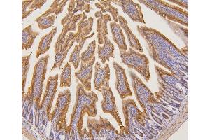 IHC analysis of PYROXD1 using anti-PYROXD1 antibody (ABIN6719650). (PYROXD1 抗体  (AA 48-230))