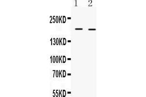 Western blot analysis of Collagen I expression in mouse kidney extract ( Lane 1) and mouse cardiac muscle extract ( Lane 2). (COL1A1 抗体  (C-Term))