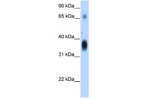 WB Suggested Anti-NOV Antibody Titration:  1. (NOV 抗体  (Middle Region))