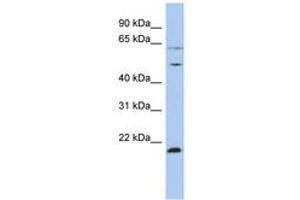 Image no. 1 for anti-Proteasome (Prosome, Macropain) 26S Subunit, ATPase, 2 (PSMC2) (N-Term) antibody (ABIN6742450) (PSMC2 抗体  (N-Term))