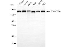 Western blotting analysis using CDC42BPA antibody (ABIN7797991).