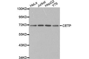 Western blot analysis of extracts of various cell lines, using CETP antibody. (CETP 抗体  (AA 300-493))