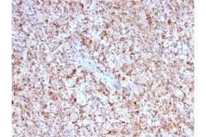 Formalin-fixed, paraffin-embedded human Spleen stained with CD40 Ligand Mouse Monoclonal Antibody (CD40LG/2763).
