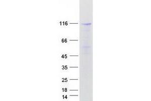 Western Blotting (WB) image for Rap Guanine Nucleotide Exchange Factor (GEF) 4 (RAPGEF4) (Transcript Variant 1) protein (Myc-DYKDDDDK Tag) (ABIN2730490)