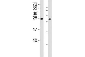 Western blot testing of RHOXF1 antibody at 1:2000; Lane 1: A2058 cell lysate, Lane 2: human ovary lysate. (RHOXF1 抗体  (AA 85-120))