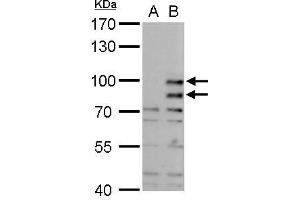 MDM2 抗体  (Center)