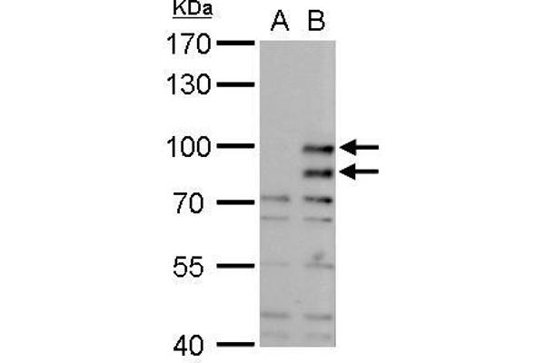 MDM2 抗体  (Center)