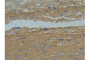 IHC-P analysis of Rat Brain Tissue, with DAB staining. (GAP43 抗体  (AA 8-226))