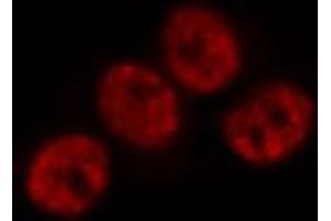ABIN6269171 staining Hela by IF/ICC. (JunD 抗体)