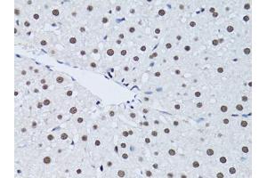 Immunohistochemistry of paraffin-embedded rat liver using PCNA antibody (ABIN1874056) at dilution of 1:100 (40x lens). (PCNA 抗体)