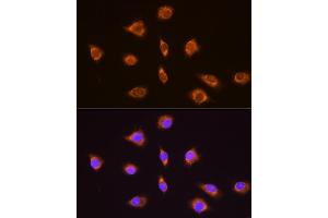Immunofluorescence (IF) image for anti-Thyrotropin-Releasing Hormone (TRH) (AA 100-200) antibody (ABIN7270826)