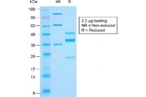 SDS-PAGE (SDS) image for anti-Keratin 10 (KRT10) antibody (ABIN6939902)