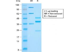 SDS-PAGE Analysis of Purified Cytokeratin 10 Mouse Recombinant Monoclonal Antibody (rKRT10/844).