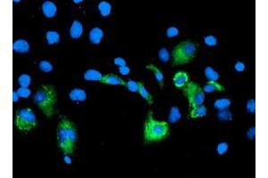 Image no. 3 for anti-Carboxypeptidase A2 (Pancreatic) (CPA2) antibody (ABIN1497594) (Carboxypeptidase A2 抗体)