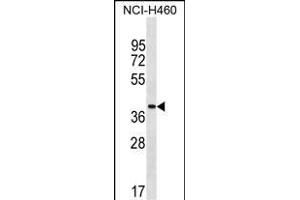ZN Antibody (Center) (ABIN1537874 and ABIN2849918) western blot analysis in NCI- cell line lysates (35 μg/lane). (ZNF488 抗体  (AA 149-175))