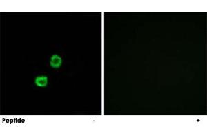 Immunofluorescence analysis of MCF-7 cells, using GCNT7 polyclonal antibody . (GCNT7 抗体)