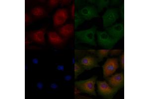 ABIN6265163 and ABIN6272472 staining  cells by IF/ICC.