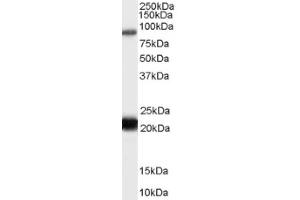 Image no. 1 for anti-RAS Protein Activator Like 1 (GAP1 Like) (RASAL1) (C-Term) antibody (ABIN375234) (RASAL1 抗体  (C-Term))