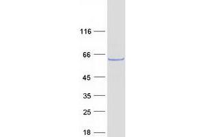 Western Blotting (WB) image for Leucine-rich repeat protein SHOC-2 (SHOC2) protein (Myc-DYKDDDDK Tag) (ABIN2732005)