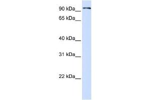 PCDHB13 antibody used at 1 ug/ml to detect target protein. (PCDHB13 抗体  (Middle Region))
