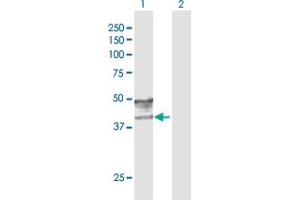 Western Blot analysis of GCNT2 expression in transfected 293T cell line by GCNT2 MaxPab polyclonal antibody. (GCNT2 抗体  (AA 1-402))