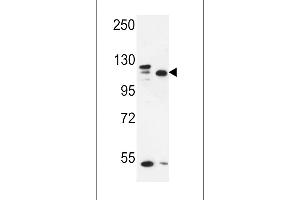 Western blot analysis in MDA-MB435,MCF-7 cell line lysates (35ug/lane). (SEC24C 抗体  (AA 443-470))