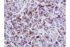 Immunohistochemistry (IHC) image for anti-CD8 (CD8) antibody (ABIN1449140) (CD8 抗体)