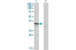 Western Blot analysis of RPA2 expression in transfected 293T cell line by RPA2 MaxPab polyclonal antibody. (RPA2 抗体  (AA 1-270))