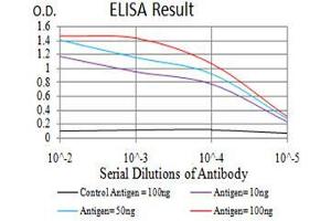 Black line: Control Antigen (100 ng),Purple line: Antigen (10 ng), Blue line: Antigen (50 ng), Red line:Antigen (100 ng) (CFHR5 抗体  (AA 344-569))