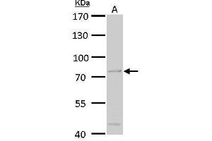 WB Image ACOX3 antibody detects ACOX3 protein by Western blot analysis. (ACOX3 抗体  (C-Term))