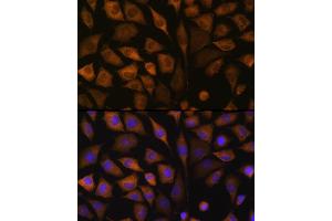 Immunofluorescence (IF) image for anti-Staphylococcal Nuclease Domain Containing Protein 1 (SND1) (AA 26-285) antibody (ABIN6148197)