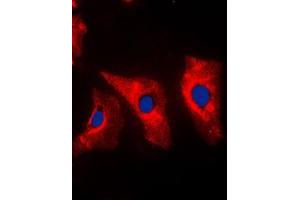 Immunofluorescent analysis of Vimentin staining in MCF7 cells. (Vimentin 抗体  (C-Term))