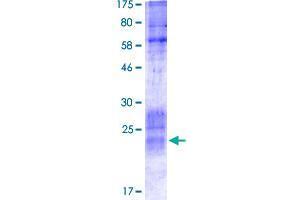 SDS-PAGE (SDS) image for CD276 (CD276) (AA 28-140) protein (His-DYKDDDDK-Strep II Tag) (ABIN4369856)