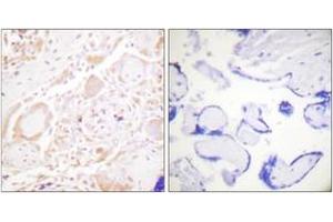 Immunohistochemistry analysis of paraffin-embedded human placenta tissue, using GATA3 (Ab-308) Antibody. (GATA3 抗体  (AA 274-323))