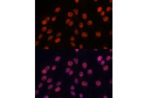 Immunofluorescence analysis of C6 cells using IPO8 antibody (ABIN7267859) at dilution of 1:100. (Importin 8 抗体  (AA 878-1037))