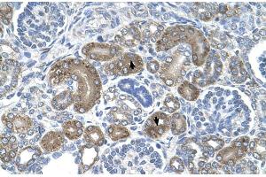 Human kidney (DCTPP1 抗体  (Middle Region))
