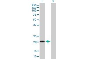 Western Blot analysis of IFNA10 expression in transfected 293T cell line by IFNA10 MaxPab polyclonal antibody. (IFNA10 抗体  (AA 1-189))