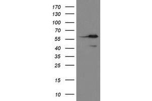 Image no. 3 for anti-Methionyl Aminopeptidase 2 (METAP2) (AA 2-212) antibody (ABIN1491153)