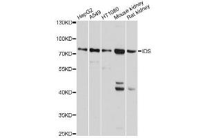 Western blot analysis of extracts of various cell lines, using IDS antibody. (IDS 抗体  (AA 34-290))