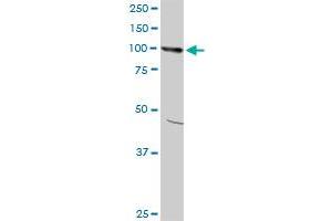 AMPD2 monoclonal antibody (M09), clone 6A8. (AMPD2 抗体  (AA 86-185))