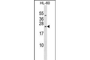RPL10L Antibody (N-term) (ABIN1539610 and ABIN2849193) western blot analysis in HL-60 cell line lysates (35 μg/lane). (RPL10L 抗体  (N-Term))