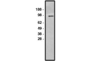Image no. 1 for anti-Solute Carrier Family 9, Subfamily A (NHE1, Cation Proton Antiporter 1), Member 1 (SLC9A1) antibody (ABIN265248) (SLC9A1 抗体)